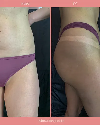 Hello Tan Opalanie natryskowe